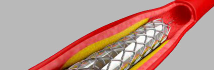 Medical Devices